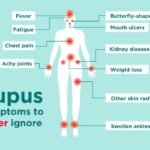 Can Discoid Lupus Kill You? Risks, Reality & Life Expectancy