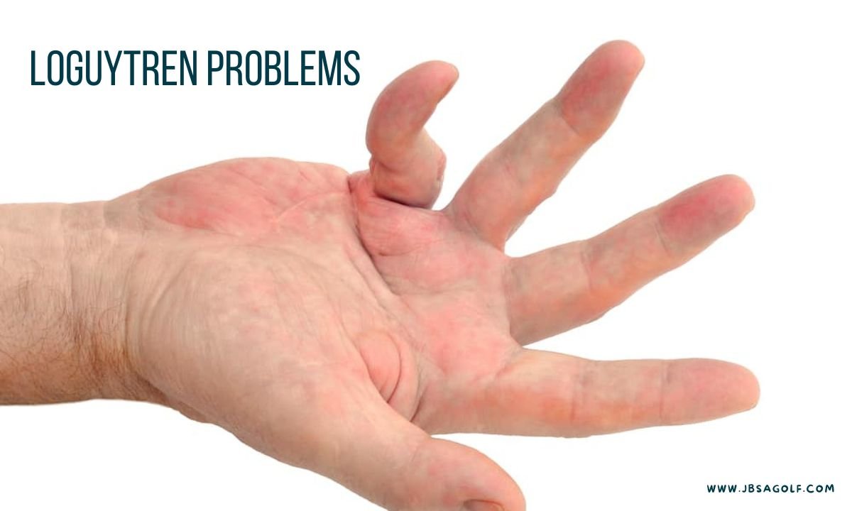 Understanding Loguytren Problems & Treatments